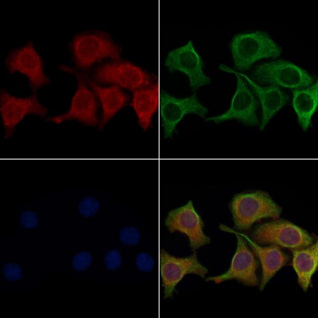 Aquaporin 0 Antibody in Immunocytochemistry (ICC/IF)