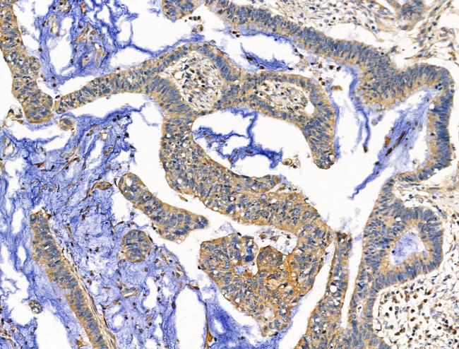 EDG2 Antibody in Immunohistochemistry (Paraffin) (IHC (P))