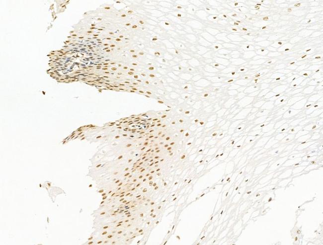 HDAC5 Antibody in Immunohistochemistry (Paraffin) (IHC (P))