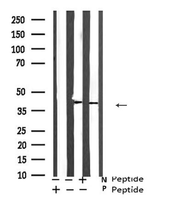 Phospho-ATF4 (Ser219) Antibody in Western Blot (WB)