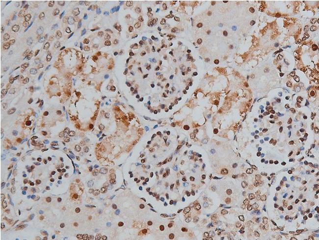 Phospho-MYPT1 (Thr853) Antibody in Immunohistochemistry (Paraffin) (IHC (P))