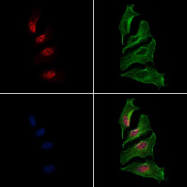 GATA3 Antibody in Immunocytochemistry (ICC/IF)