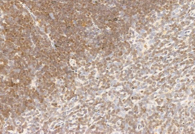 AMPK alpha Antibody in Immunohistochemistry (Paraffin) (IHC (P))