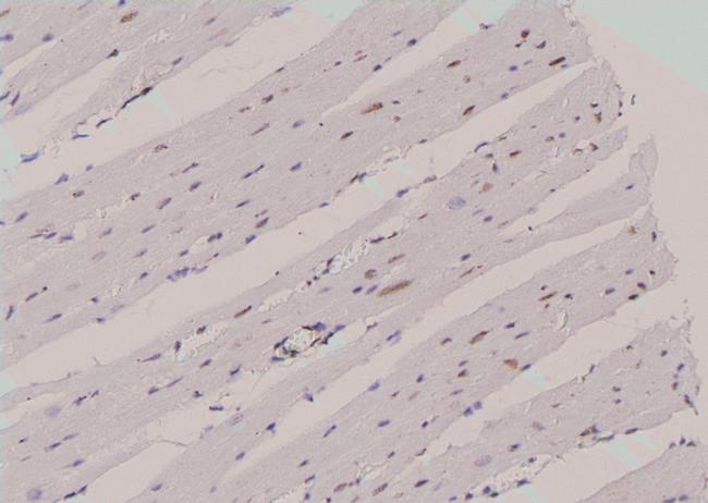 Phospho-N-WASP (Tyr256) Antibody in Immunohistochemistry (Paraffin) (IHC (P))