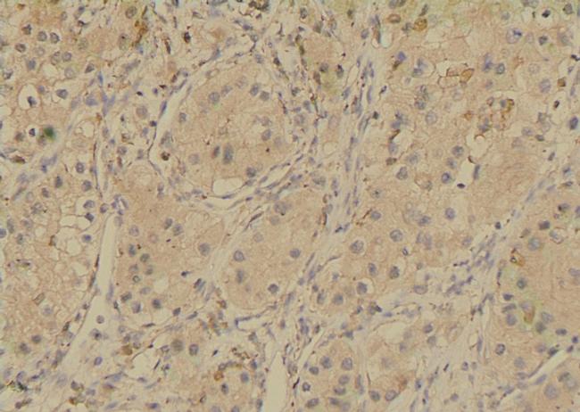 Phospho-SGLT1 (Ser335) Antibody in Immunohistochemistry (Paraffin) (IHC (P))