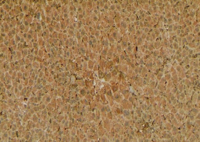 Phospho-FABP1 (Ser11) Antibody in Immunohistochemistry (Paraffin) (IHC (P))