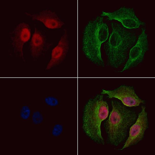 Phospho-NEK2 (Ser171) Antibody in Immunocytochemistry (ICC/IF)