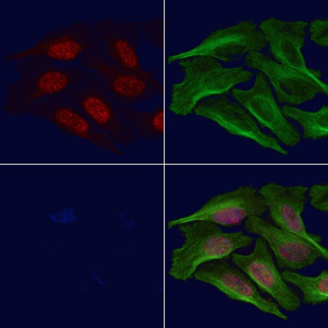 Phospho-BCL11A (Ser205) Antibody in Immunocytochemistry (ICC/IF)