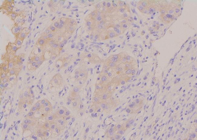 Phospho-HPRT1 (Ser110) Antibody in Immunohistochemistry (Paraffin) (IHC (P))