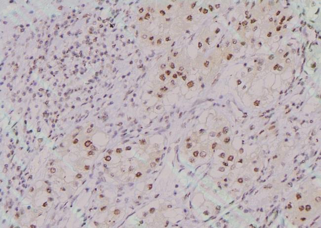 Phospho-TRIM32 (Ser339) Antibody in Immunohistochemistry (Paraffin) (IHC (P))