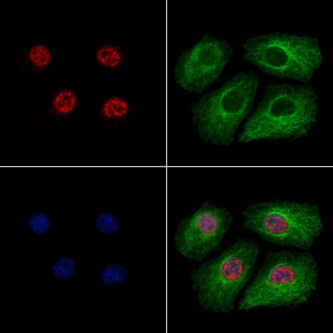 Phospho-Caspase 2 Precursor (Ser340) Antibody in Immunocytochemistry (ICC/IF)