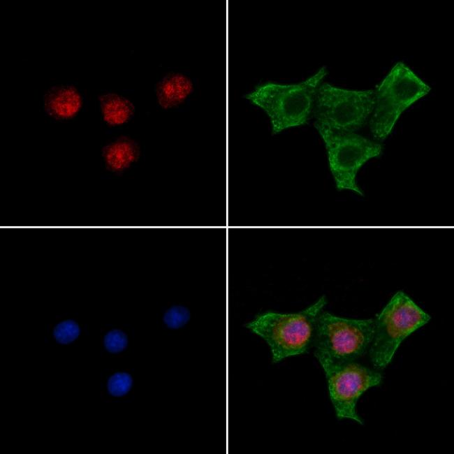 Phospho-MYOD (Thr115) Antibody in Immunocytochemistry (ICC/IF)