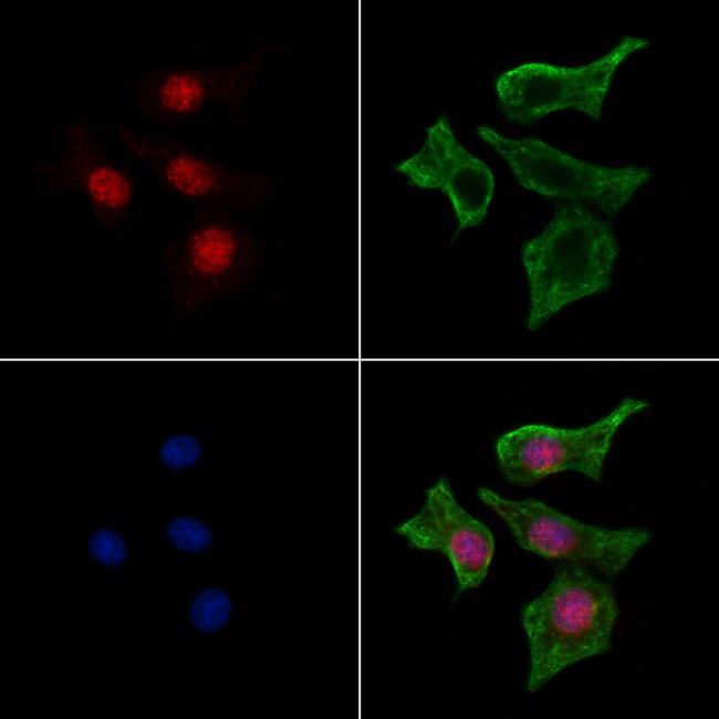 Phospho-SP7 (Thr319) Antibody in Immunocytochemistry (ICC/IF)