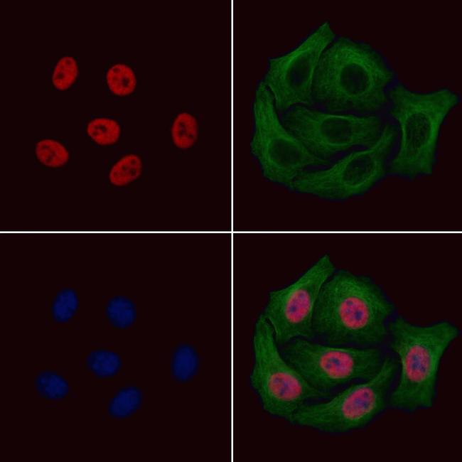 Phospho-PAX7 (Ser203) Antibody in Immunocytochemistry (ICC/IF)