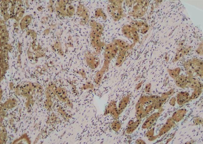 Phospho-ABCB11 (Ser690) Antibody in Immunohistochemistry (Paraffin) (IHC (P))