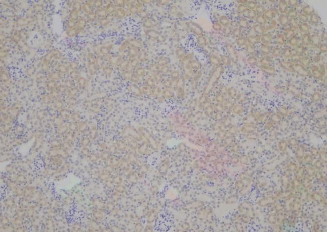 Phospho-PLD2 (Tyr511) Antibody in Immunohistochemistry (Paraffin) (IHC (P))