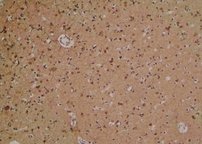 Phospho-MYPT1 (Ser299) Antibody in Immunohistochemistry (Paraffin) (IHC (P))