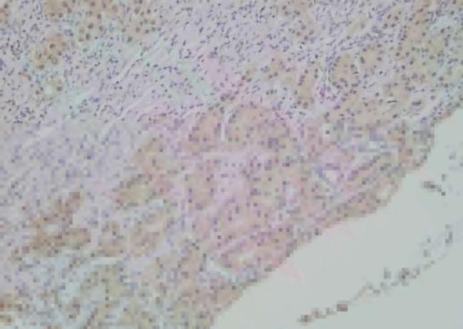 Phospho-SHIP2 (Tyr886) Antibody in Immunohistochemistry (Paraffin) (IHC (P))