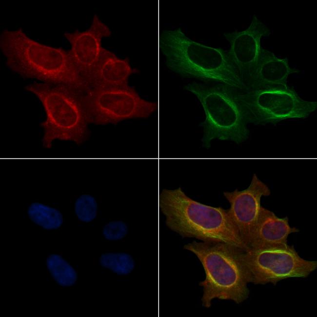 Phospho-SHIP2 (Tyr671) Antibody in Immunocytochemistry (ICC/IF)