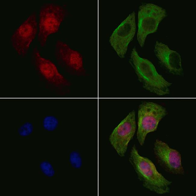 Phospho-FANCA (Ser1449) Antibody in Immunocytochemistry (ICC/IF)