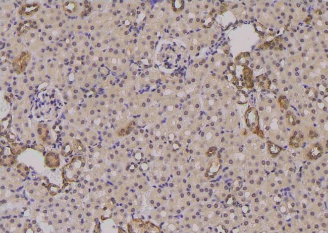 Phospho-Survivin (Thr48) Antibody in Immunohistochemistry (Paraffin) (IHC (P))