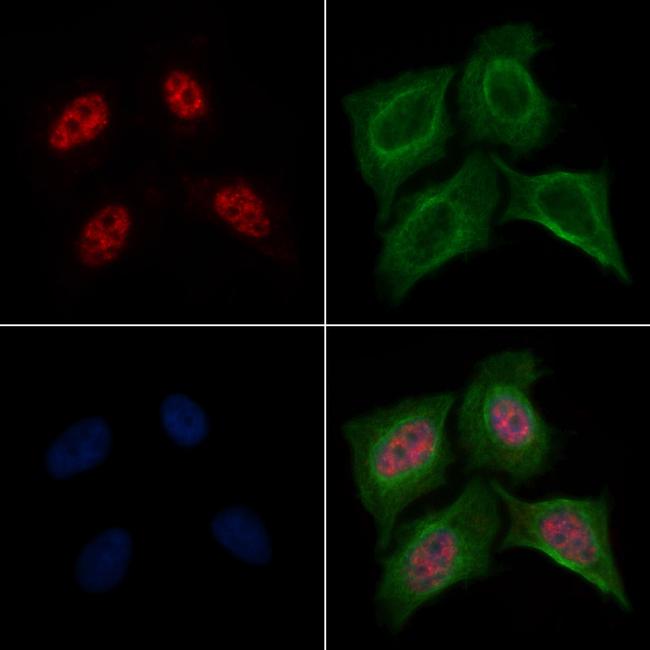 Phospho-PDPK1 (Thr245) Antibody in Immunocytochemistry (ICC/IF)