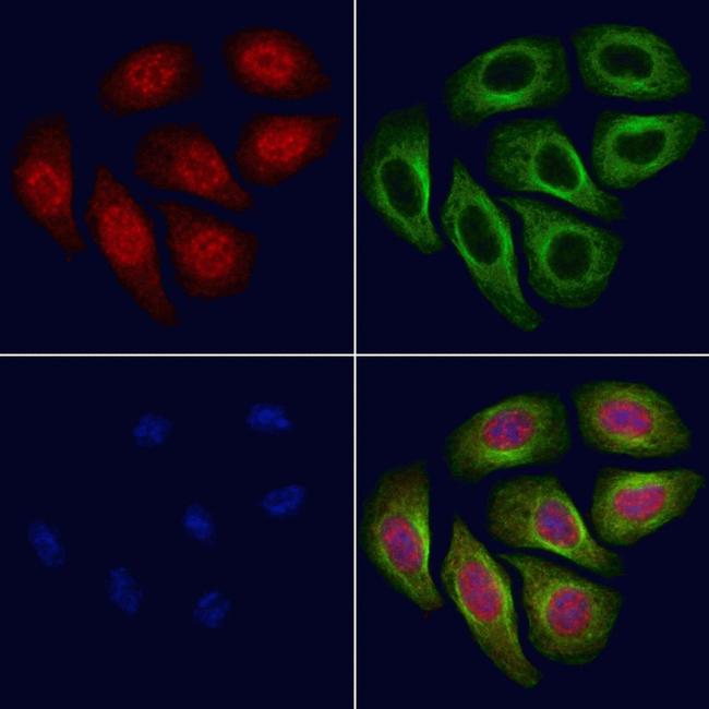 Phospho-FoxO3a (Ser644) Antibody in Immunocytochemistry (ICC/IF)