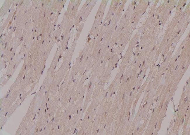 Phospho-PFKFB2 (Ser32) Antibody in Immunohistochemistry (Paraffin) (IHC (P))