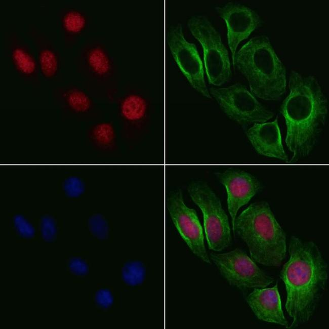 Phospho-NBS1 (Ser432) Antibody in Immunocytochemistry (ICC/IF)