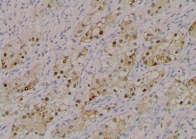 Phospho-MiTF (Ser414) Antibody in Immunohistochemistry (Paraffin) (IHC (P))