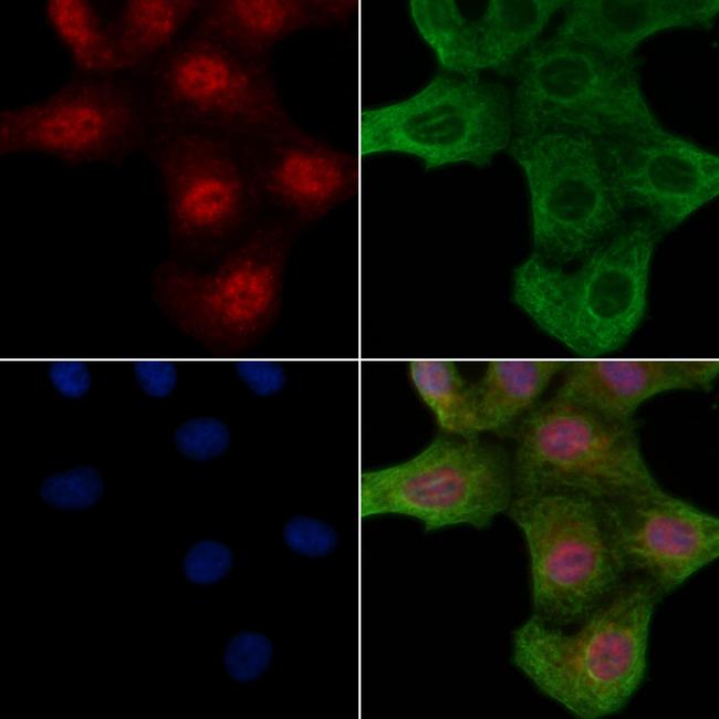 Phospho-ROCK2 (Ser1366) Antibody in Immunocytochemistry (ICC/IF)