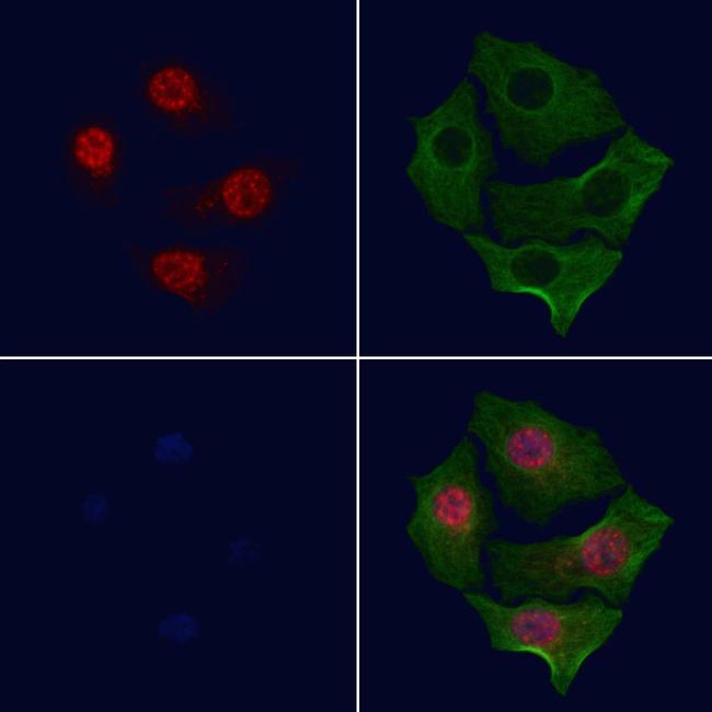 Phospho-c-Myc (Ser293) Antibody in Immunocytochemistry (ICC/IF)