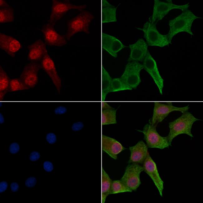 Phospho-Lamin A/C (Ser301) Antibody in Immunocytochemistry (ICC/IF)