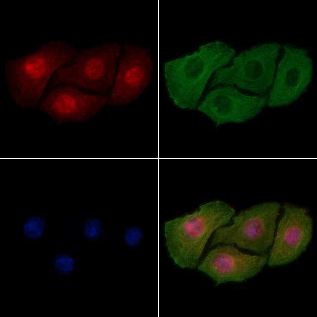 Phospho-ErbB2 (HER-2) (Tyr735) Antibody in Immunocytochemistry (ICC/IF)