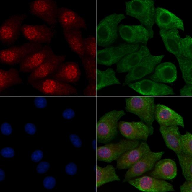 Phospho-p53 (Tyr327) Antibody in Immunocytochemistry (ICC/IF)