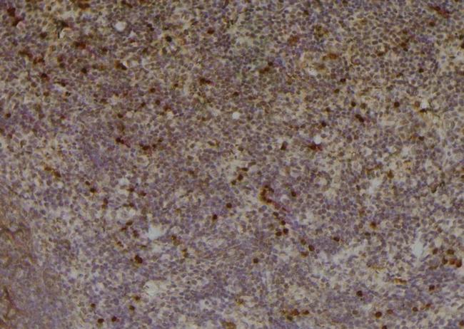 Phospho-PKC beta-1 (Thr642, Thr644) Antibody in Immunohistochemistry (Paraffin) (IHC (P))