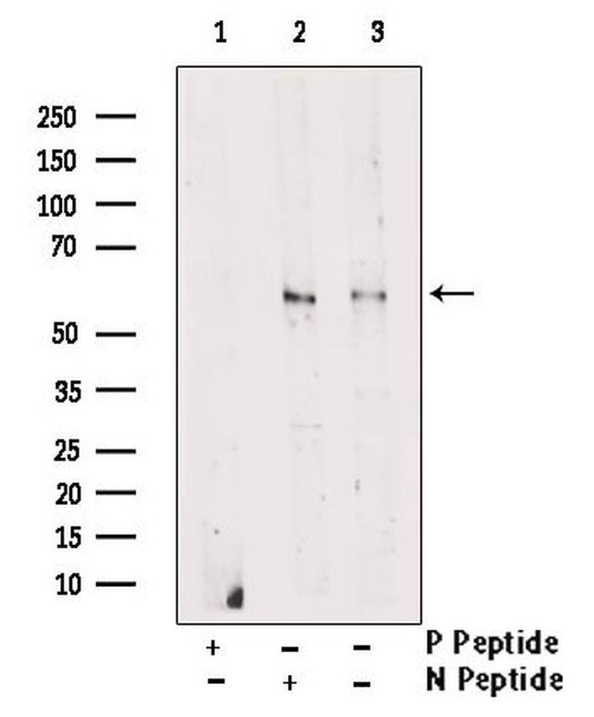 Phospho-LCK (Tyr505) Antibody in Western Blot (WB)