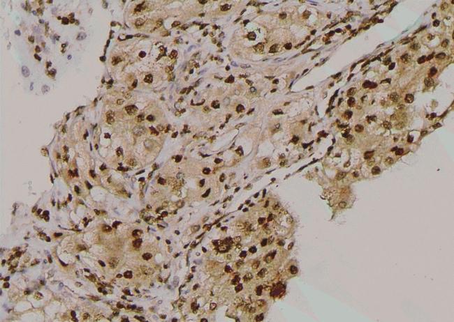 Phospho-beta-2 Adrenergic Receptor (Thr68) Antibody in Immunohistochemistry (Paraffin) (IHC (P))