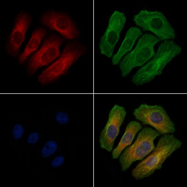 Phospho-EPRS (Tyr377) Antibody in Immunocytochemistry (ICC/IF)