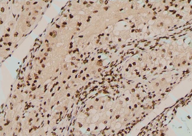 Phospho-BCR (Tyr852) Antibody in Immunohistochemistry (Paraffin) (IHC (P))