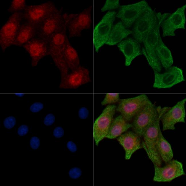 Phospho-CFTR (Thr1471) Antibody in Immunocytochemistry (ICC/IF)