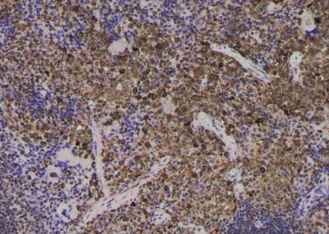 Phospho-EEF2 (Thr57) Antibody in Immunohistochemistry (Paraffin) (IHC (P))