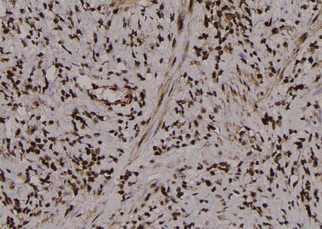 Phospho-PKM2 (Tyr370) Antibody in Immunohistochemistry (Paraffin) (IHC (P))