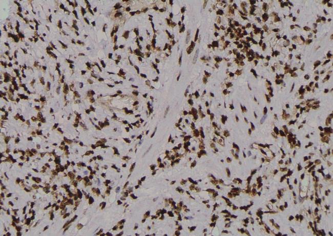 Phospho-PKM2 (Ser148) Antibody in Immunohistochemistry (Paraffin) (IHC (P))