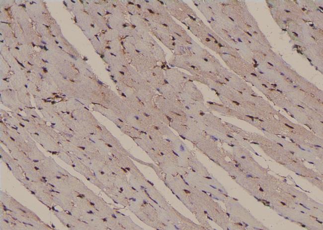 Phospho-PLCG2 (Tyr1245) Antibody in Immunohistochemistry (Paraffin) (IHC (P))