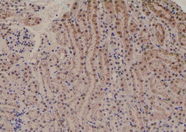 Phospho-PKC alpha (Tyr365) Antibody in Immunohistochemistry (Paraffin) (IHC (P))