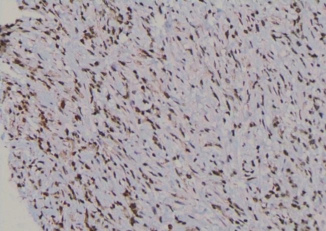 Phospho-UBF-1 (Thr117) Antibody in Immunohistochemistry (Paraffin) (IHC (P))