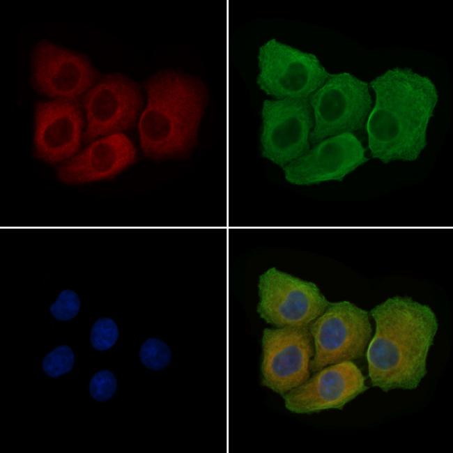 Phospho-VEGF Receptor 1 (Tyr1048) Antibody in Immunocytochemistry (ICC/IF)