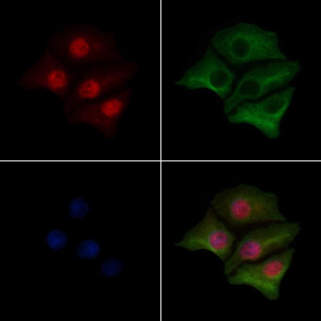 Phospho-ATF1 (Ser198) Antibody in Immunocytochemistry (ICC/IF)