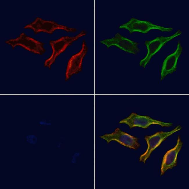 Phospho-PLCG1 (Tyr472) Antibody in Immunocytochemistry (ICC/IF)